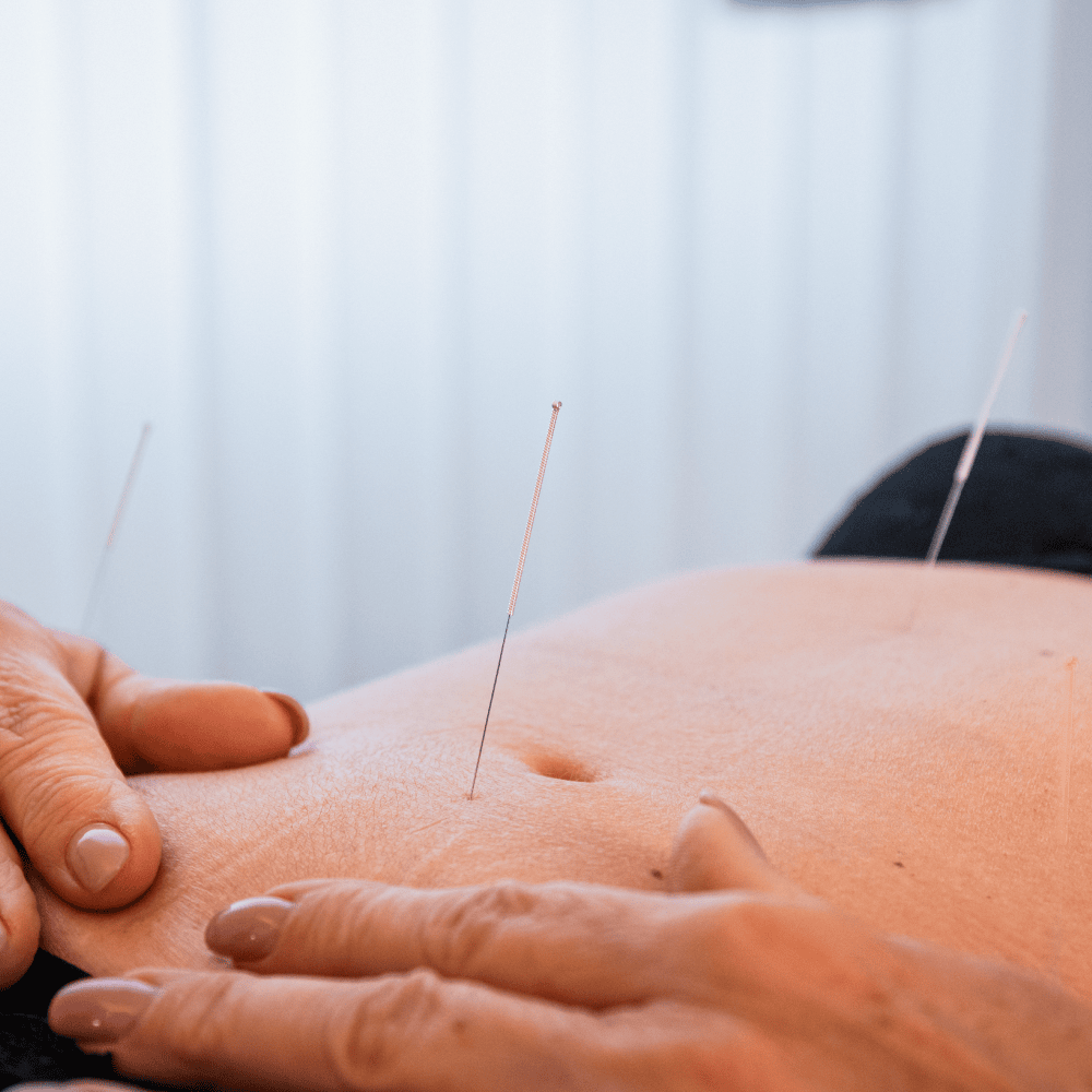 Acupuncture-Geneve-Cryo-Sport-Sante